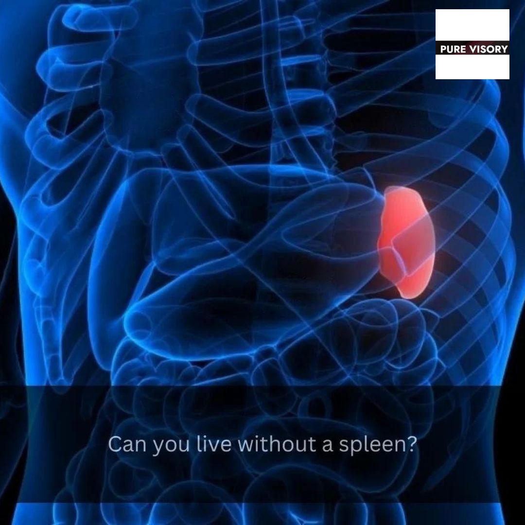 Can You Play Contact Sports Without A Spleen at Rebecca Jackson blog