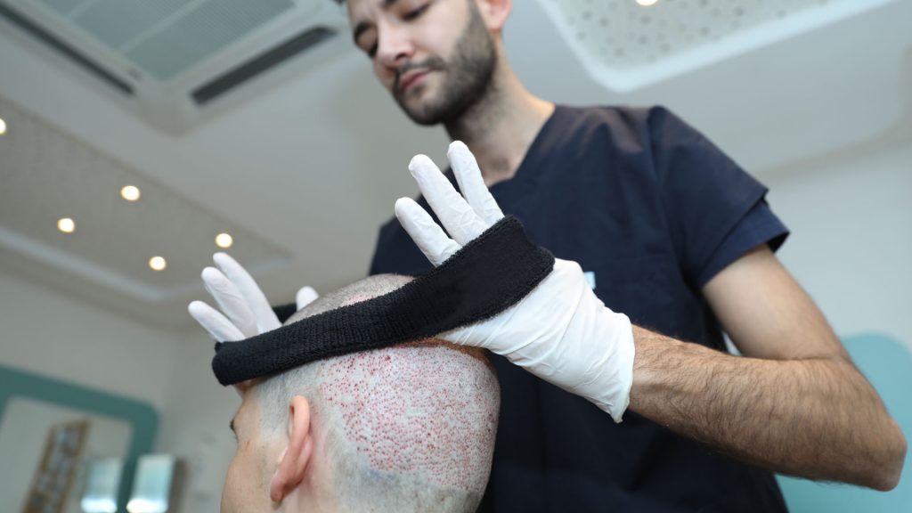 Popular Hair Loss Treatments in Abu Dhabi Vipon