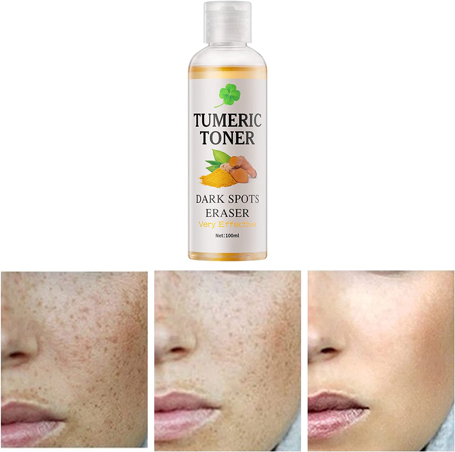 Toner for Dark Spots Turmeric Dark Spot Corrector Toner, Facial Toner